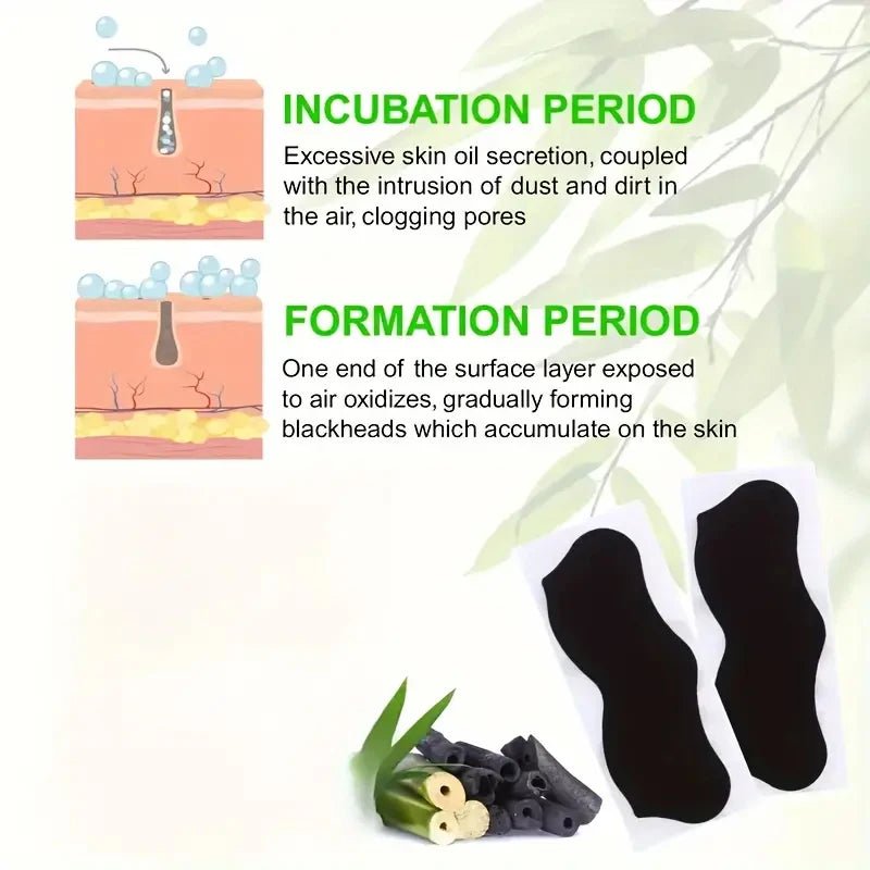 Blackhead Buster Peel Strips - FitGlamMix