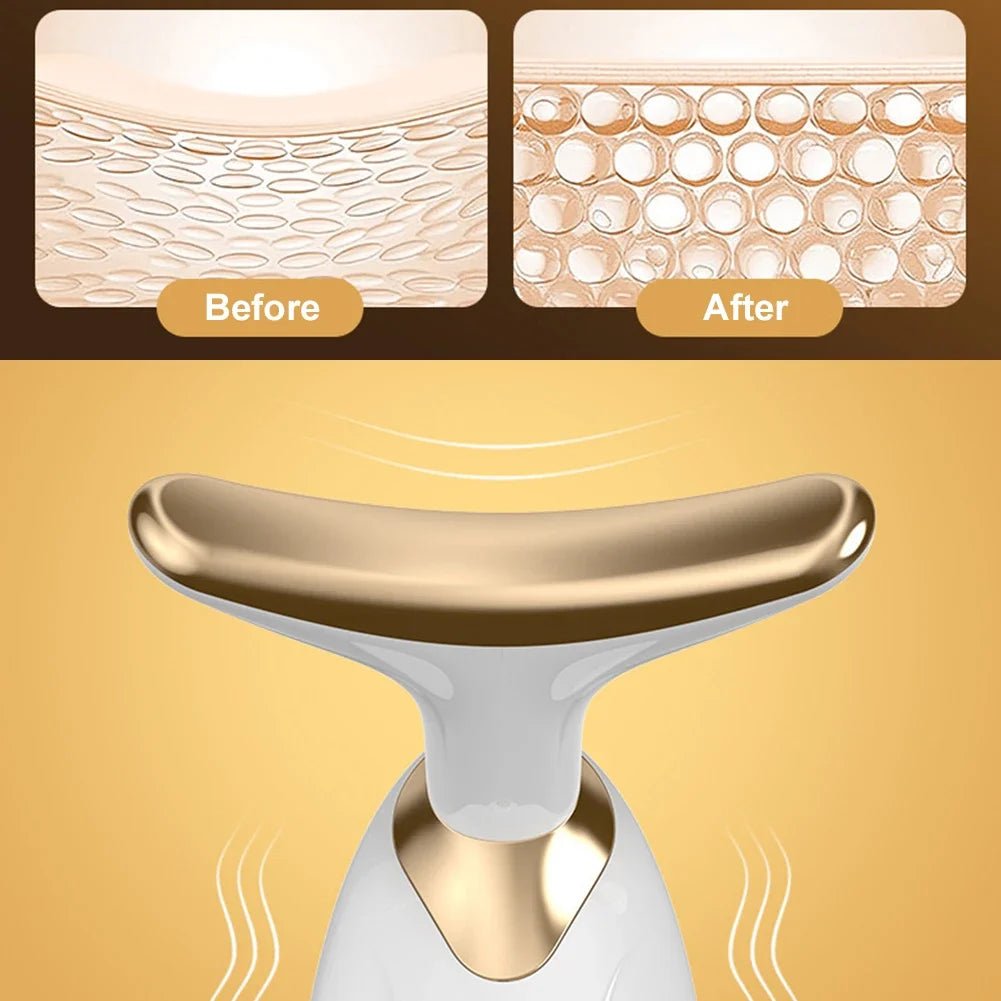 Dolphin Facial Lifter - FitGlamMix