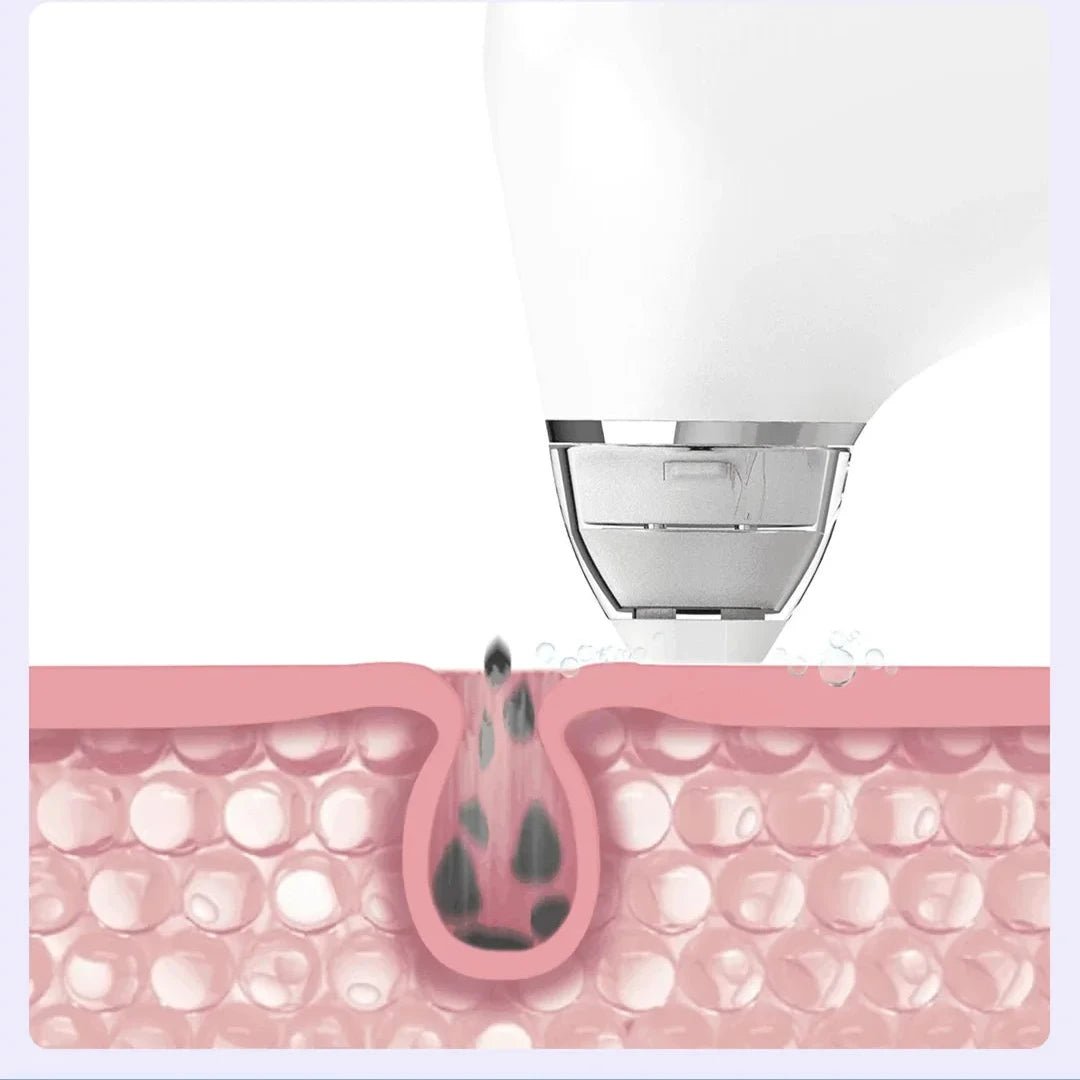 PoreVac Elite Skin Cleanser - FitGlamMix